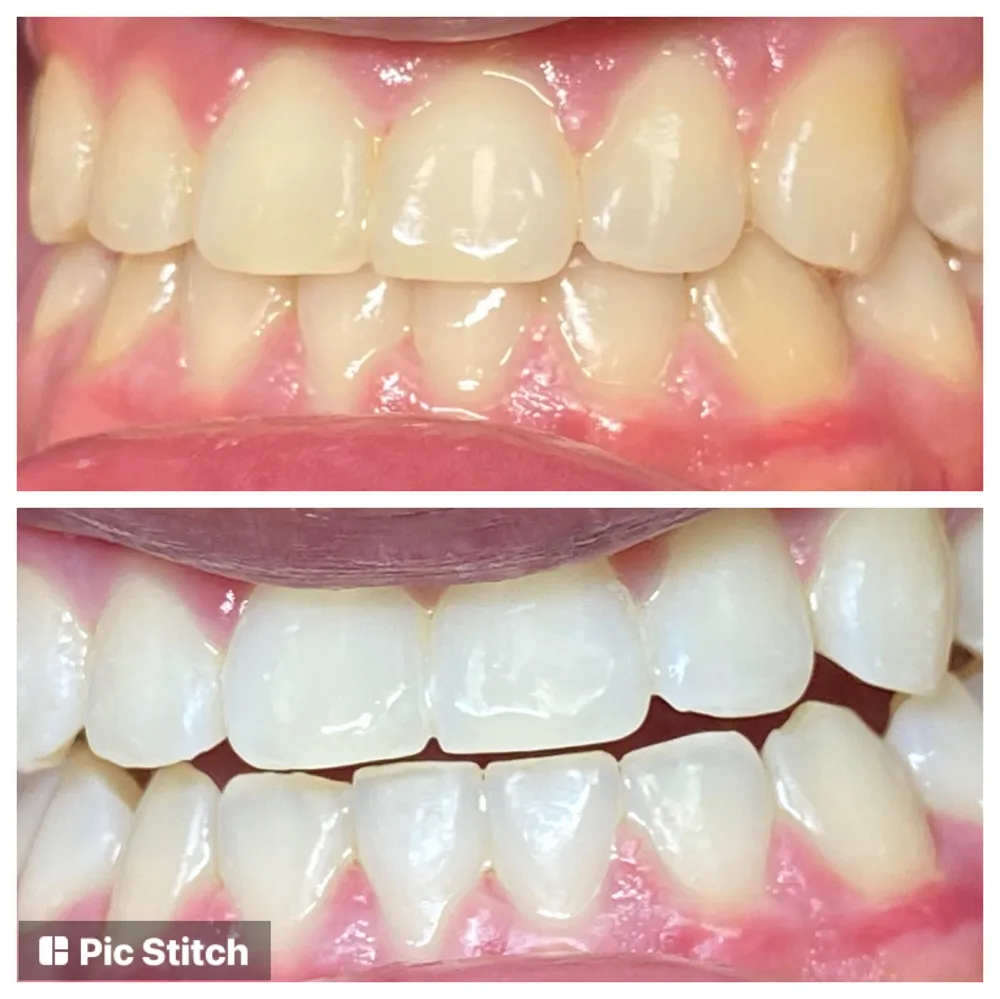 28764 high quality whitening agents