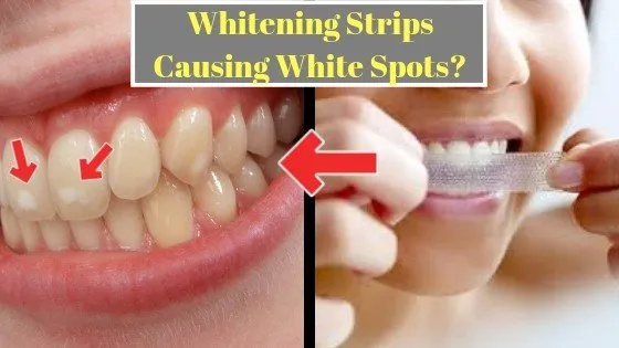 /img/28769-whitening-strips-pain-8.webp