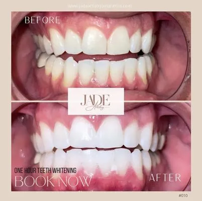 28770 healthy diet for teeth