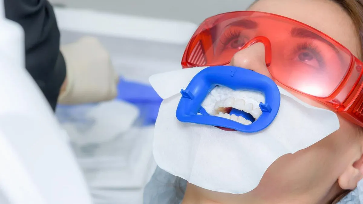 28797 fluoride treatment