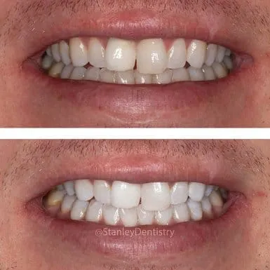 28798 kor whitening procedure