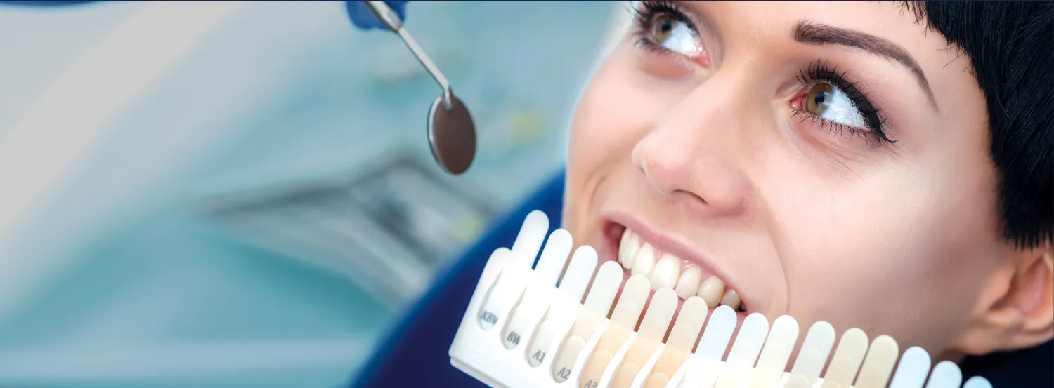 28806 at home teeth whitening