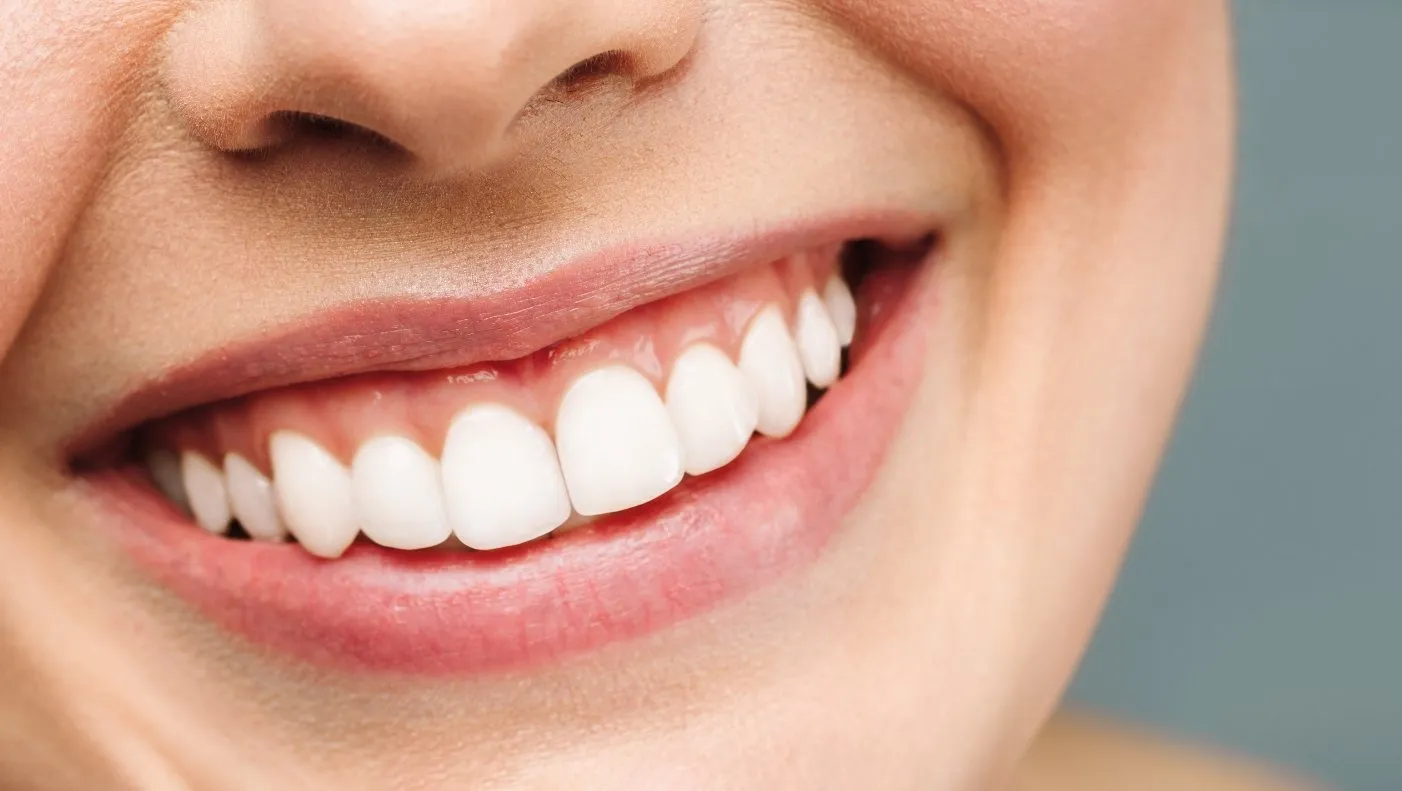 28806 teeth whitening state college