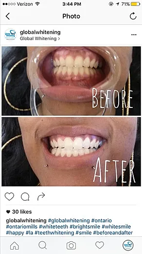 28808 spain whitening