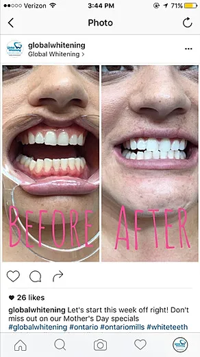 28808 turkey whitening