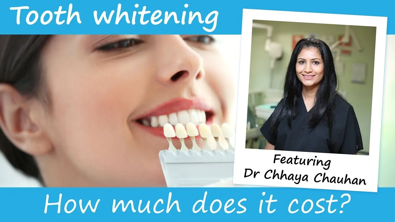 28811 teeth whitening cost