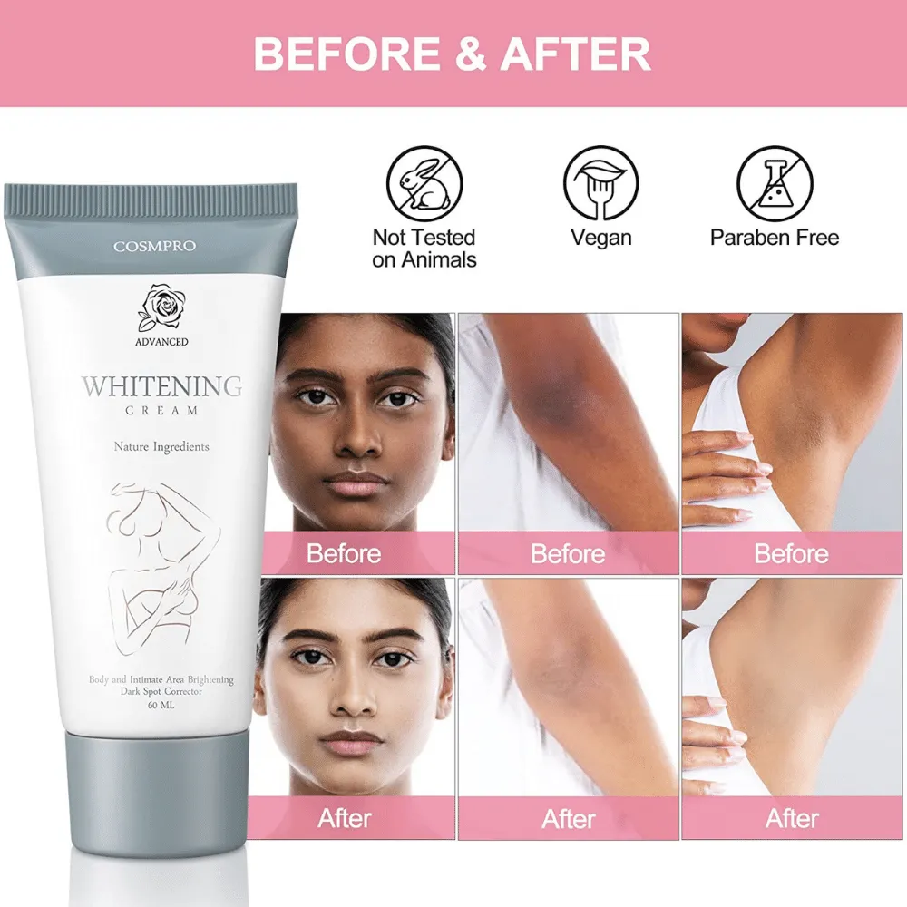 28812 skin whitening cream dark skin 2