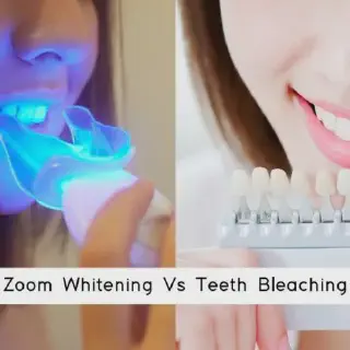 /img/28815-teeth-whitening-safety.webp