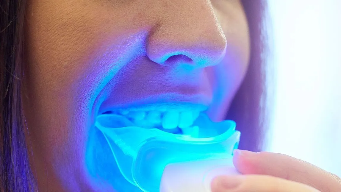 28820 effectiveness of teeth whitening lights