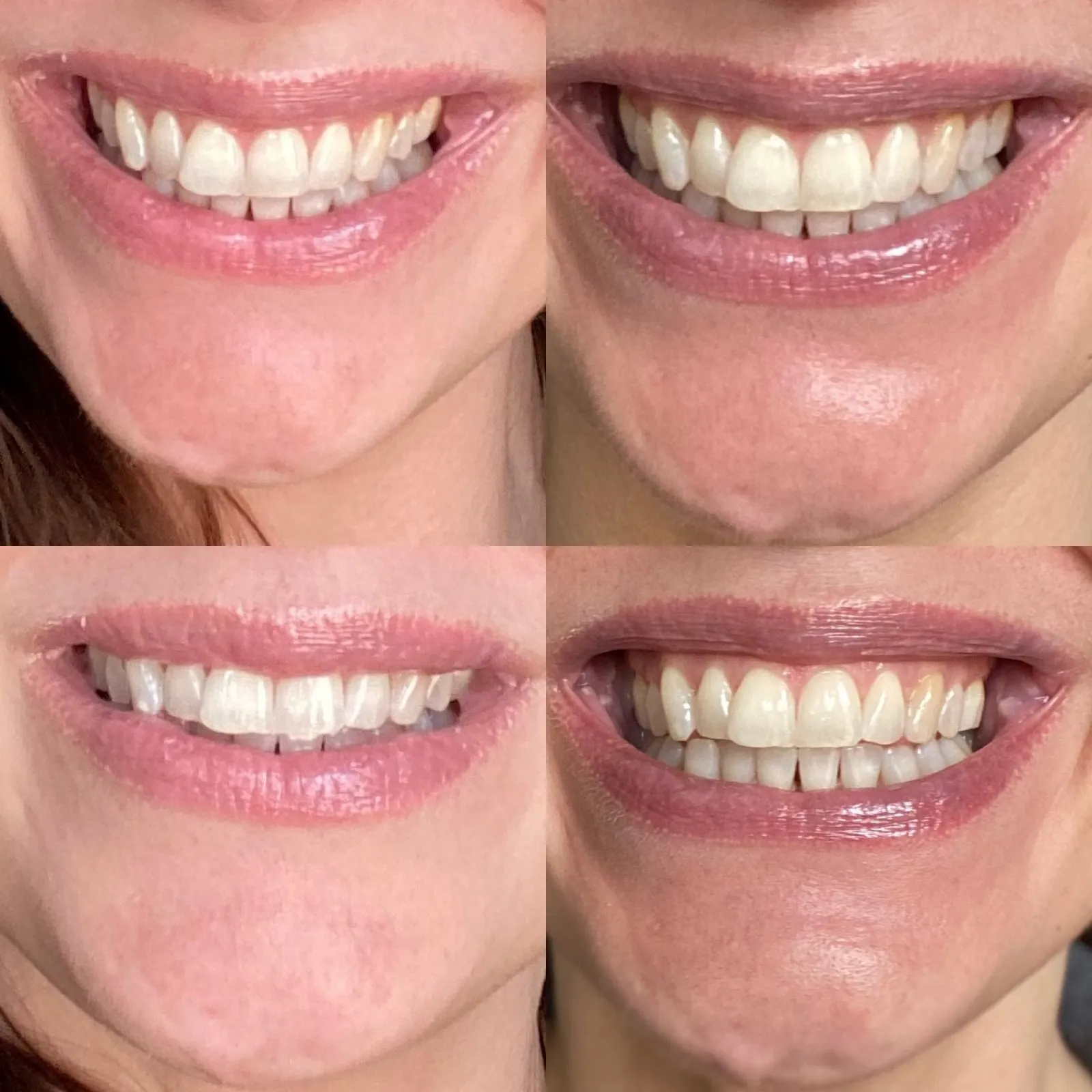 28822 spotlight smile application