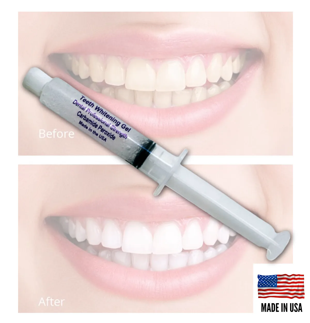 28825 teeth whitening wholesale usa image 5