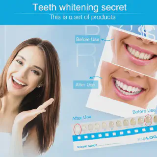 /img/28825-teeth-whitening-wholesale-usa-image-8.webp