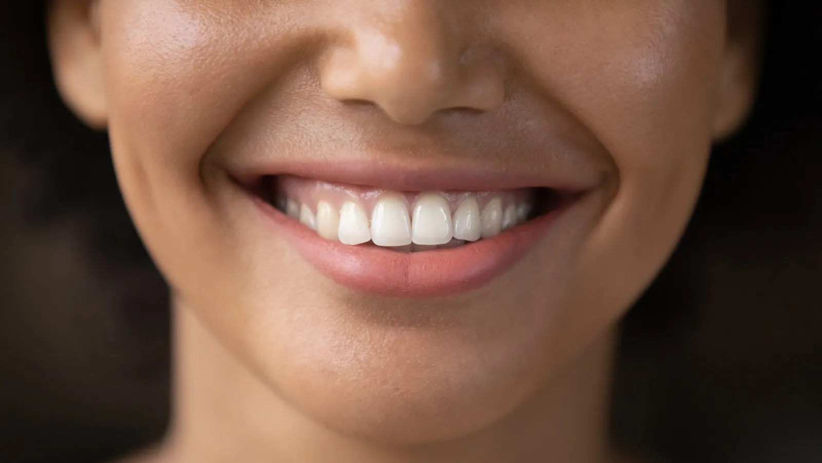 28828 teeth whitening application