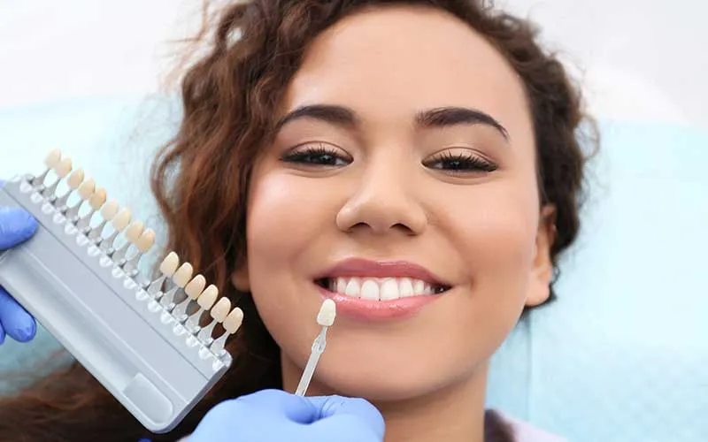 28831 in office teeth whitening