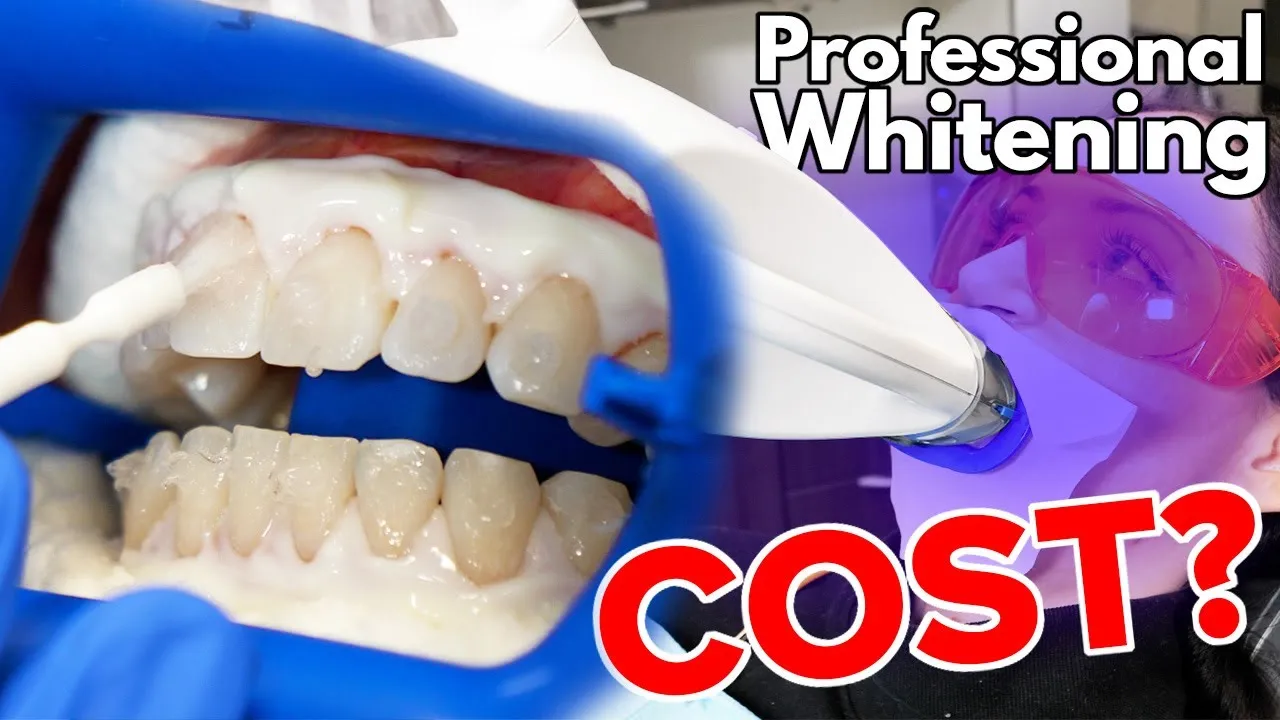 28831 teeth whitening options
