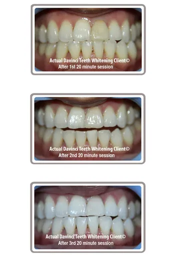 28836 allergy reaction