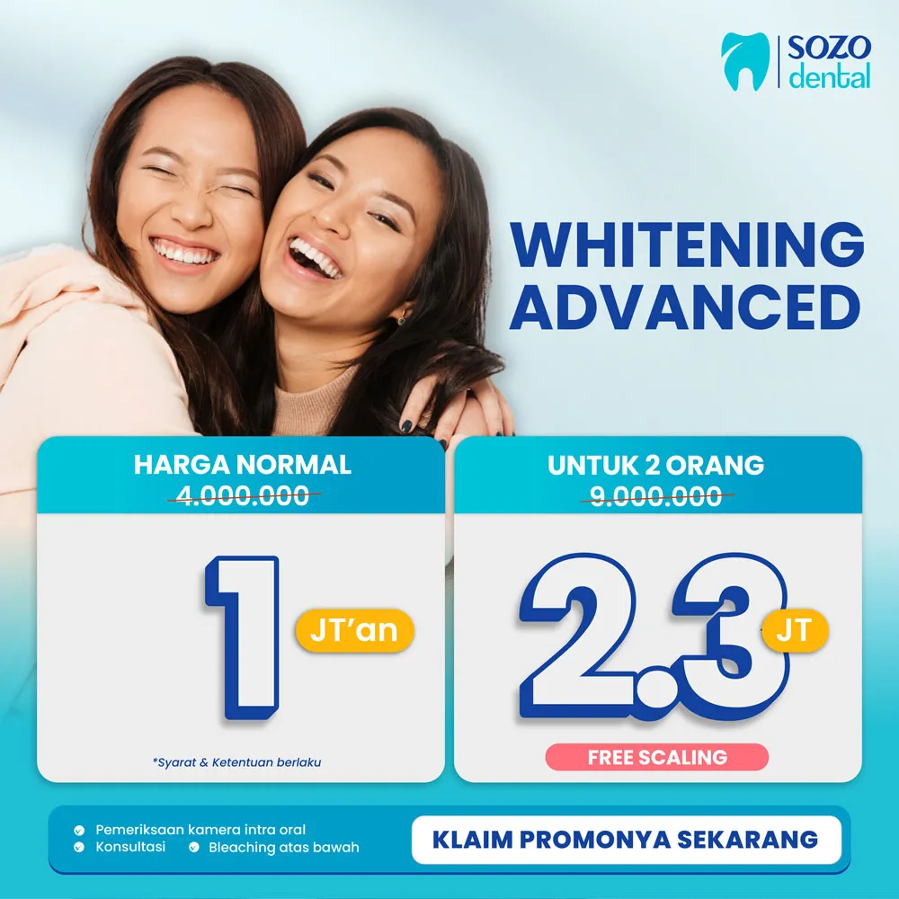 28840 at home teeth whitening kits