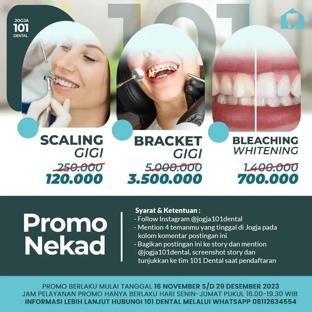 28840 before after teeth whitening