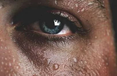 28848 diaphoresis treatment