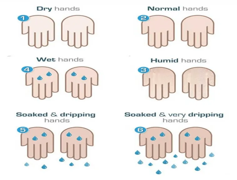 28848 medical causes diaphoresis
