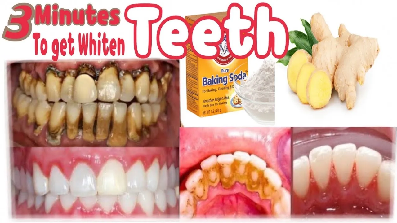 28852 teeth whitening application