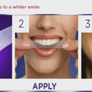 /img/28854-professional-teeth-whitening.webp