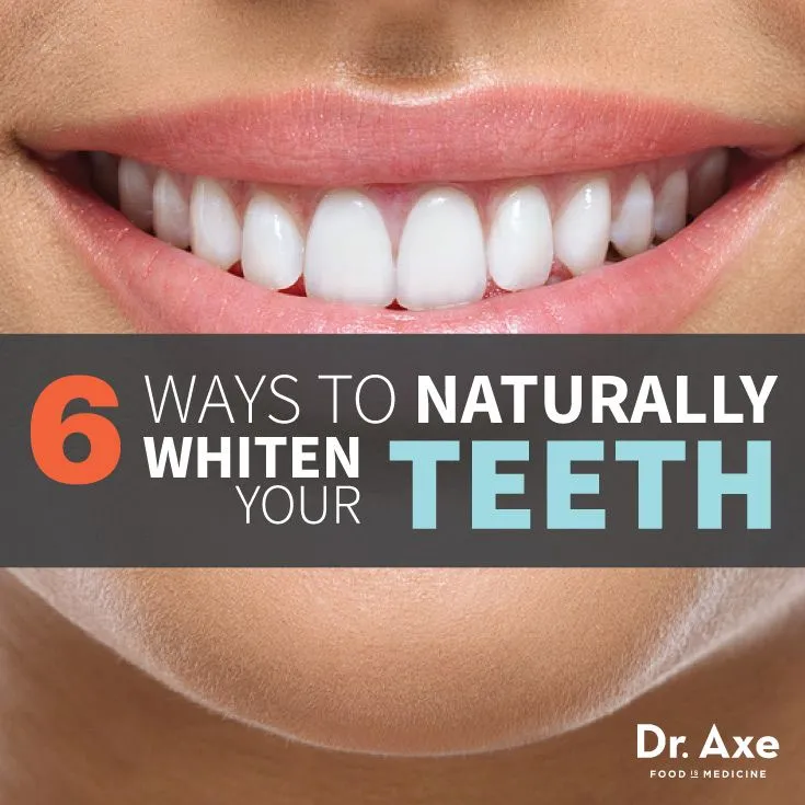 28855 teeth whitening