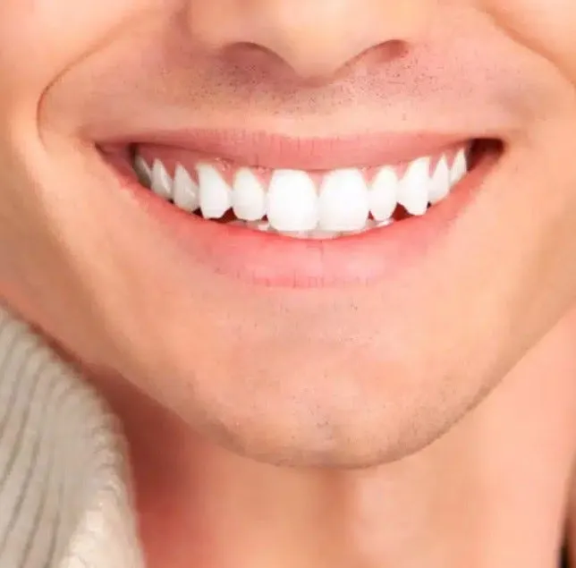 28860 teeth whitening process