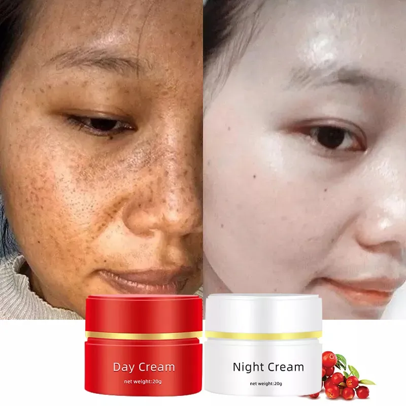 28863 whitening freckle cream