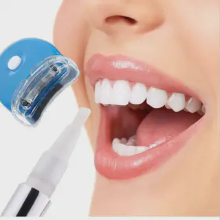 /img/28866-laser-teeth-whitening-smile.webp