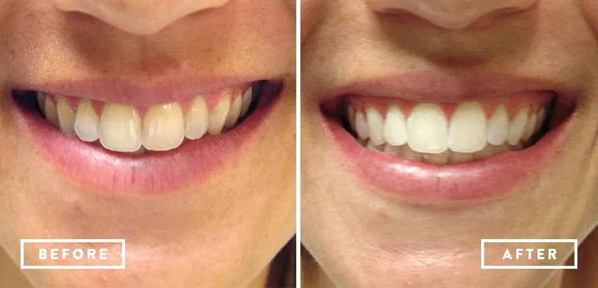 28868 desensitizing toothpaste