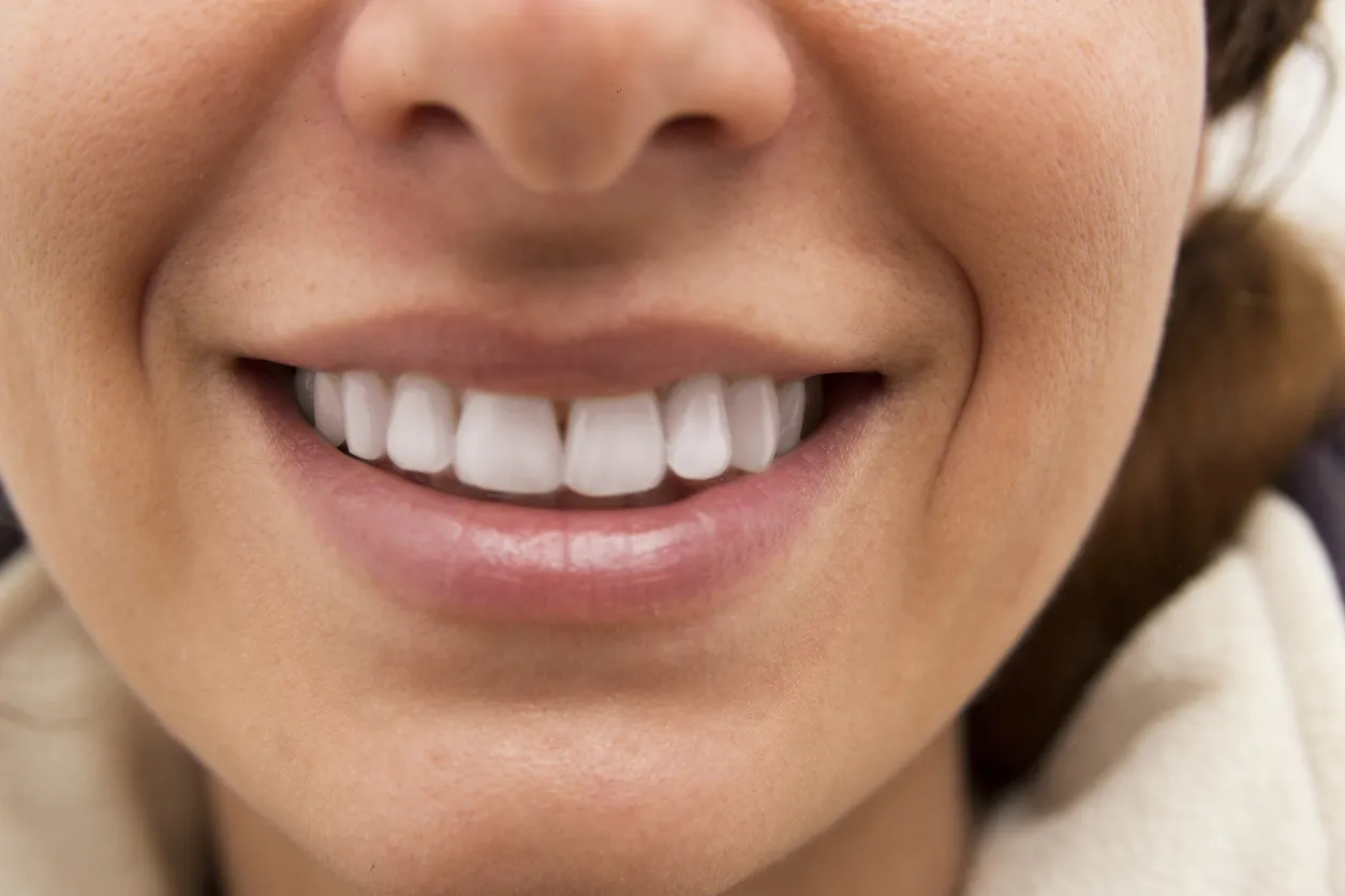 28873 teeth whitening process