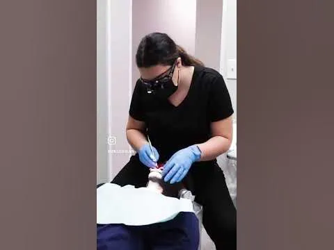 28874 natural teeth whitening