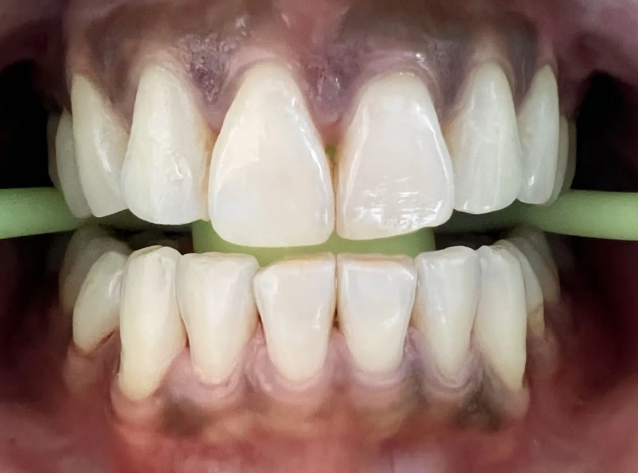 28876 polished whitening oral health