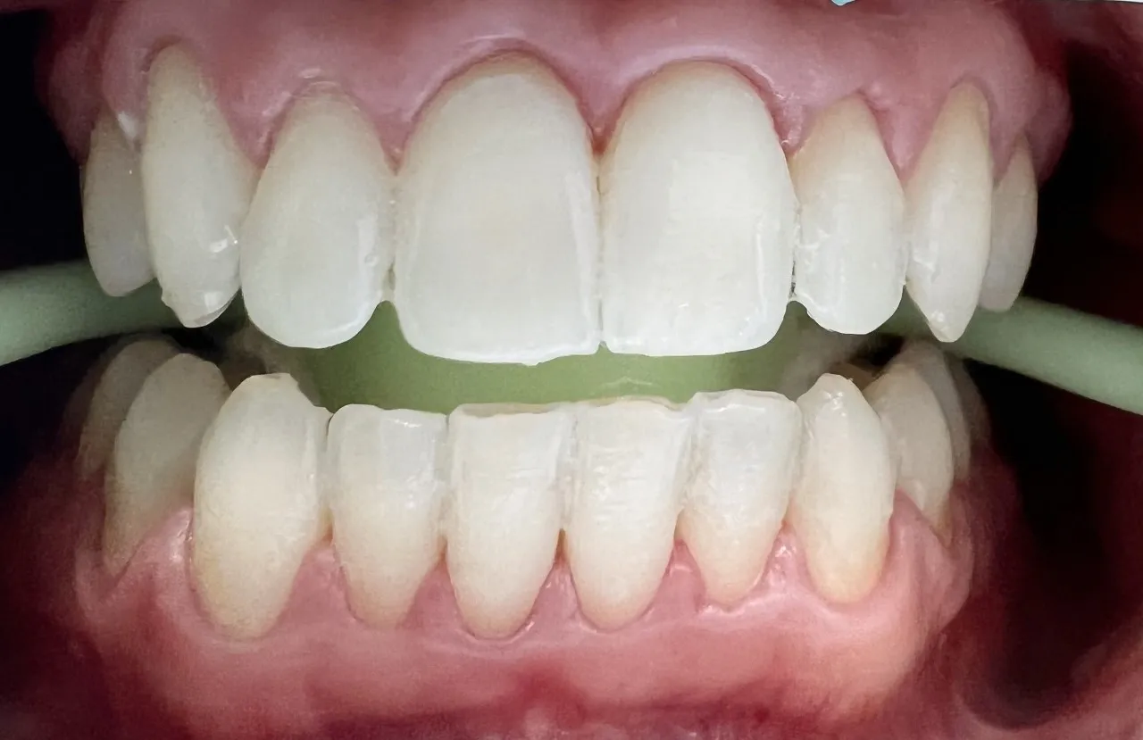 28876 polished whitening products