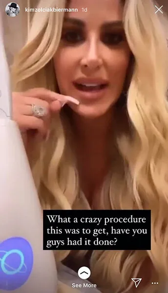 28877 at home teeth whitening products