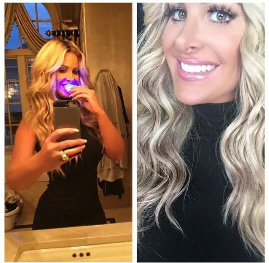 28877 teeth whitening diet