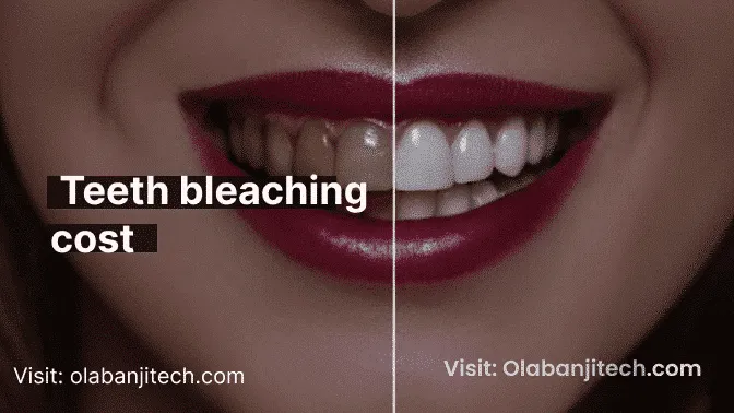 /img/28881-teeth-whitening-maintenance.webp