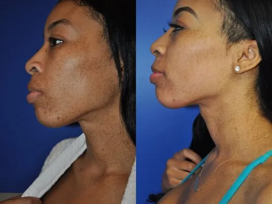 28882 post whitening care