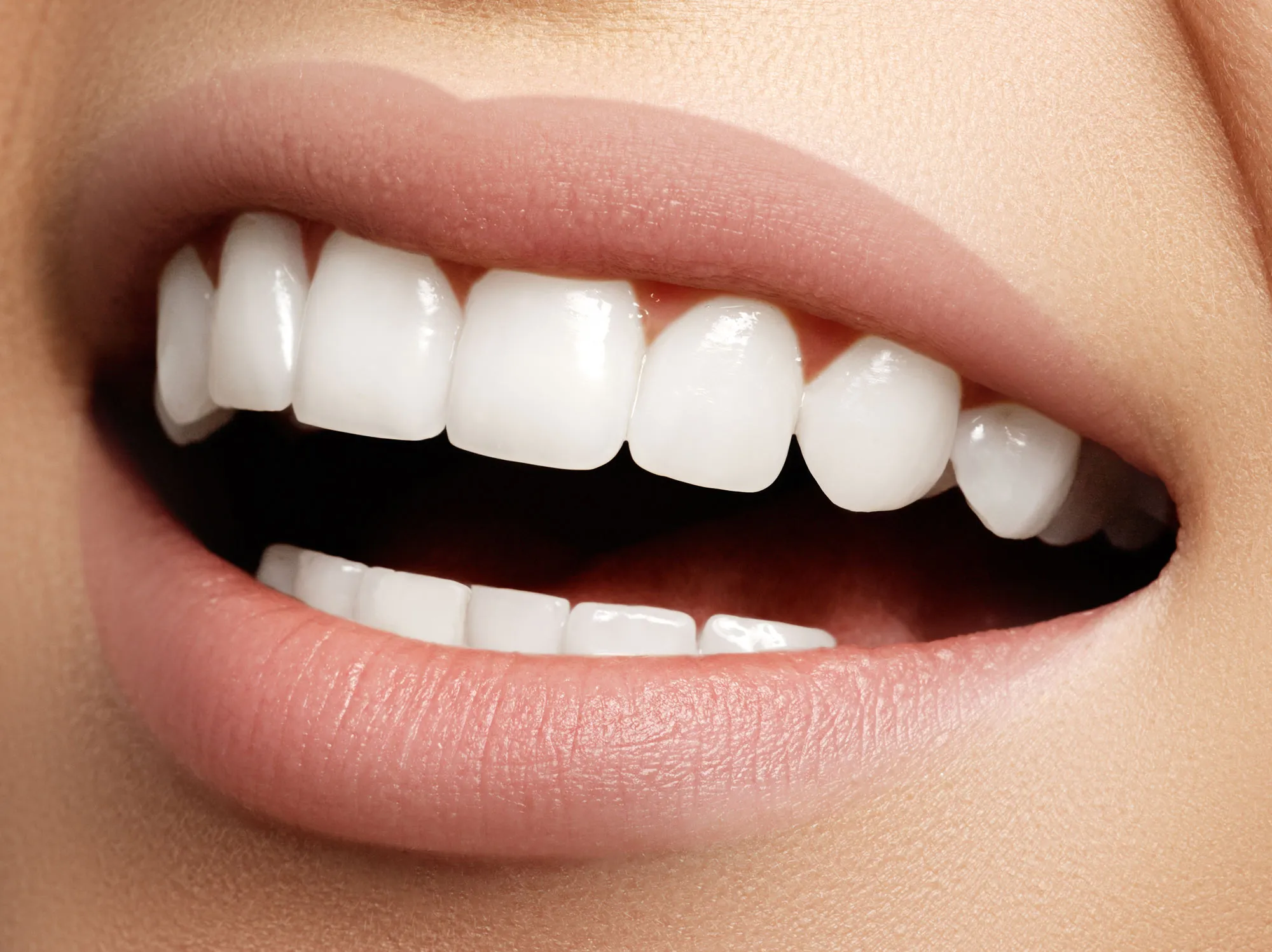 28885 professional teeth whitening