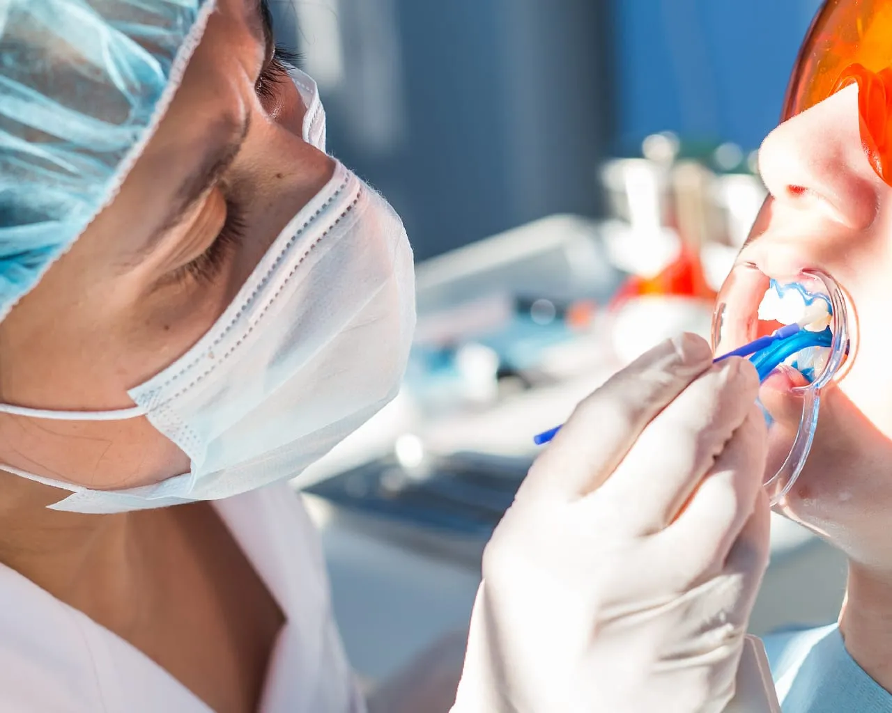 28892 at home teeth whitening kits