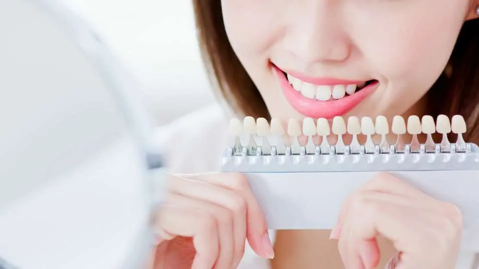28892 in office teeth whitening