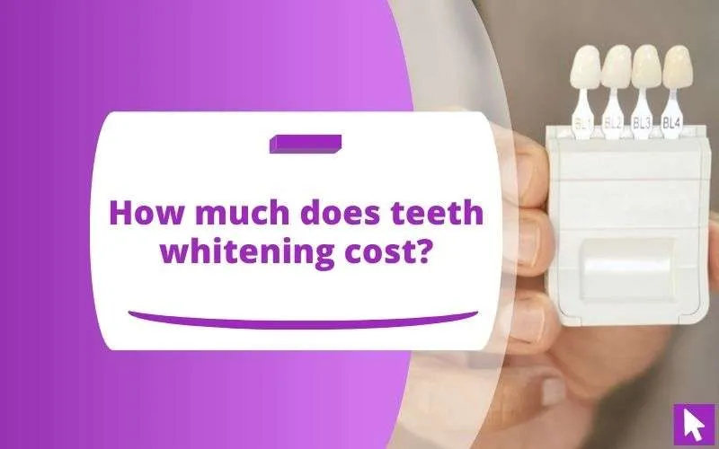 28892 teeth whitening before after