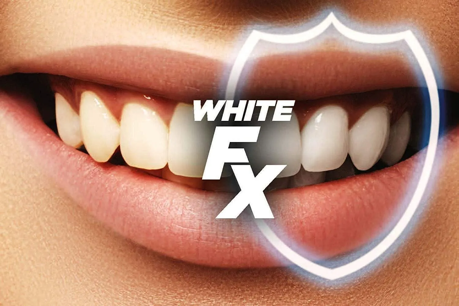 28895 at home whitening