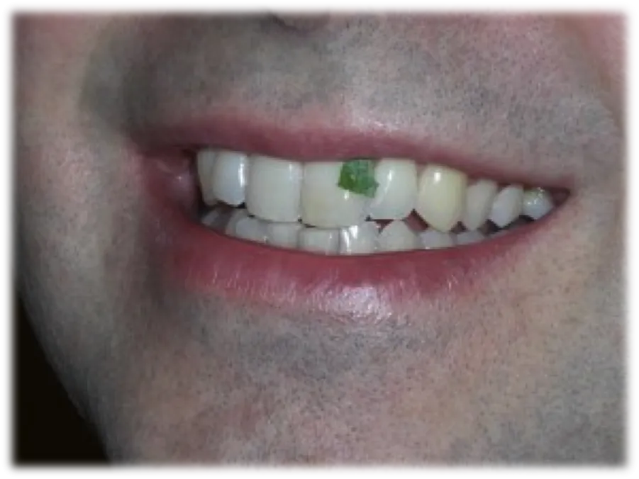 28897 spinach leaves