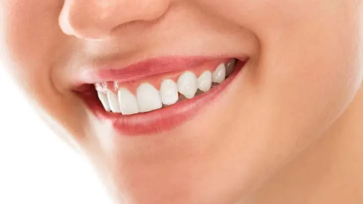 28897 spinach teeth whitening overview