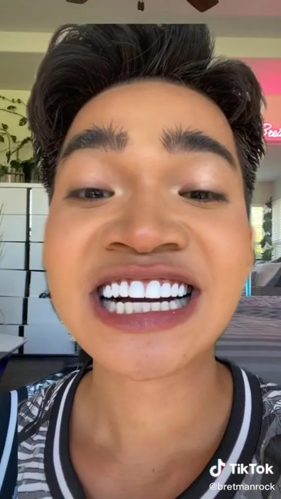 28903 bretman rock teeth whitening