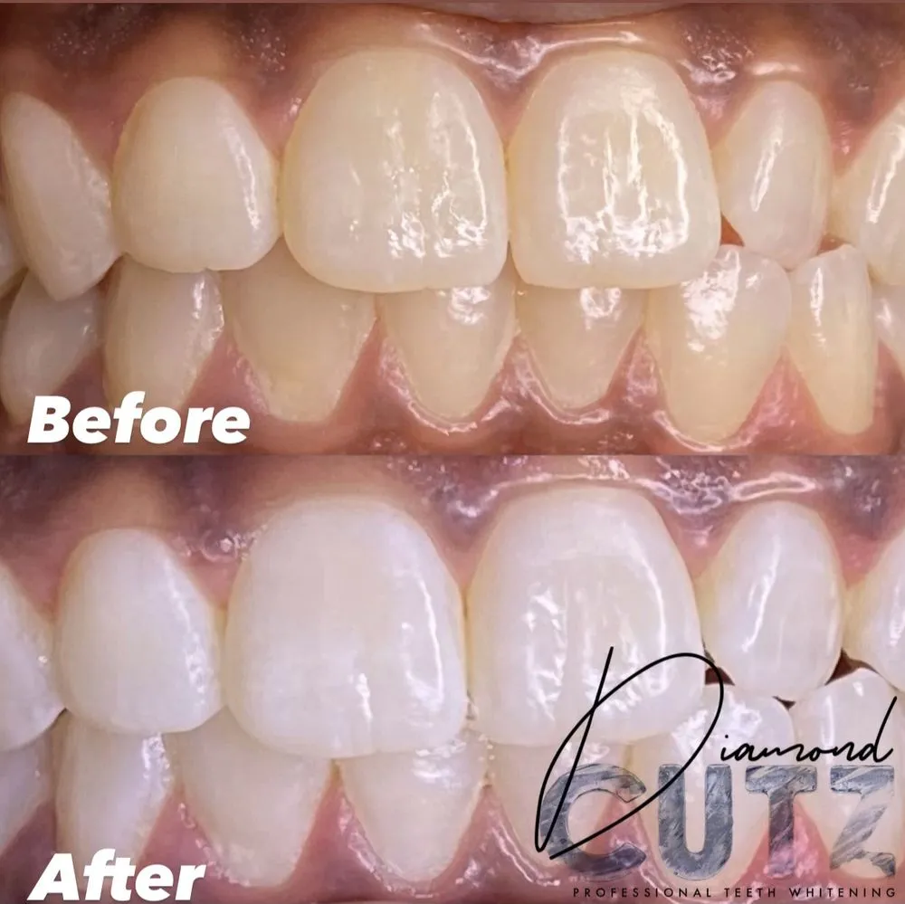 28905 teeth whitening franklin tn