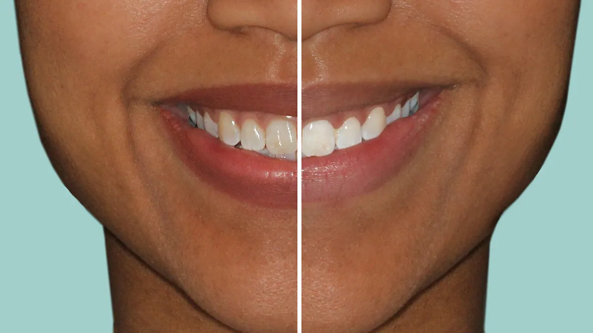 28909 intelliwhite user