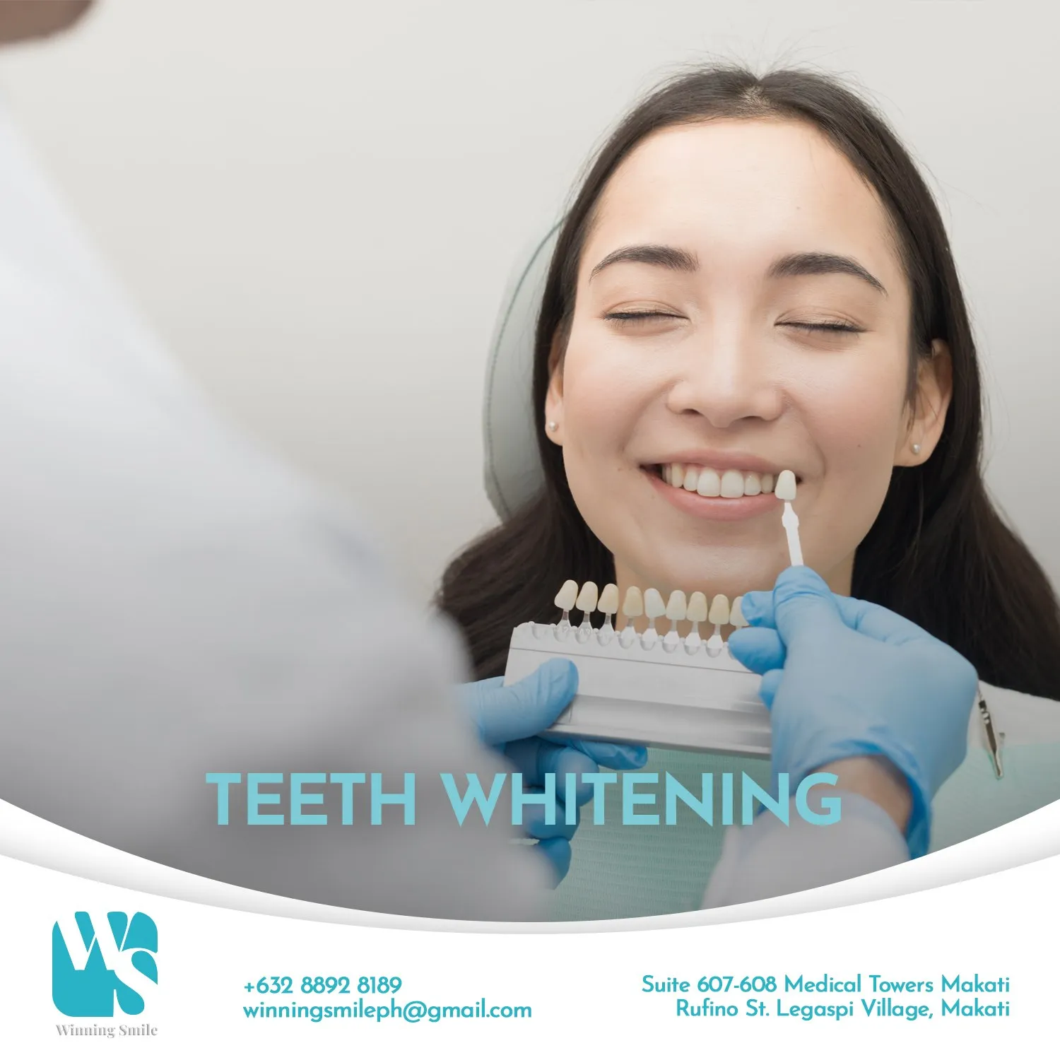 28910 teeth whitening comparison